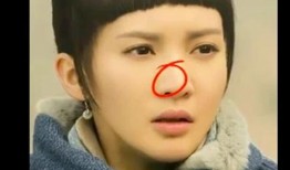 鼻子整形爆料视频,独家爆料视频大公开